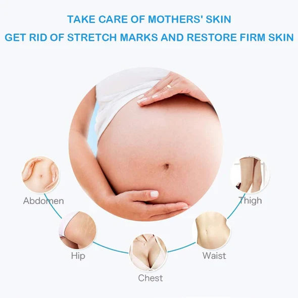 Stretch Mark Remover Anti Stretch Mark Cream 80gm 👌